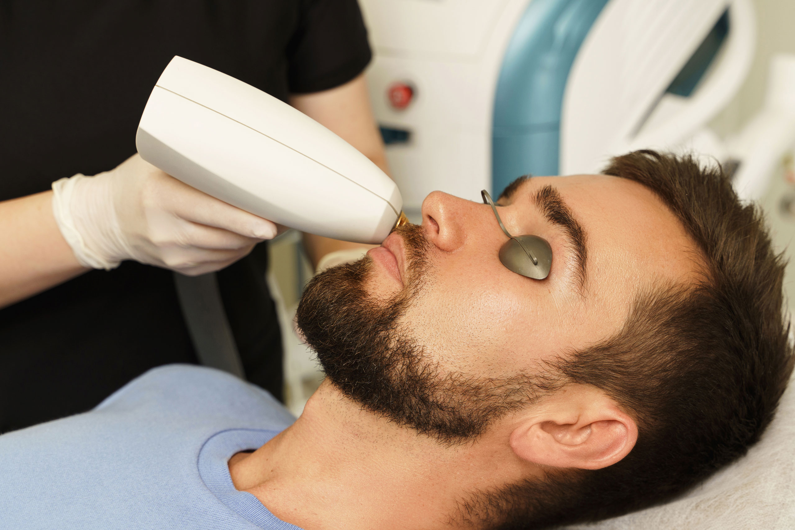 Épilation laser de la barbe Clinique Pietra